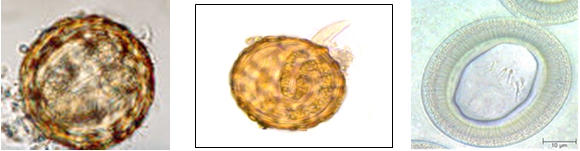 aszcariasis helminth nevezzük az intracelluláris parazitákat